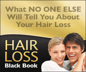 hairlossbb 300x250 1